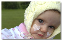 Lily suffers from Childhood Obliterative Bronchiolitis Lung